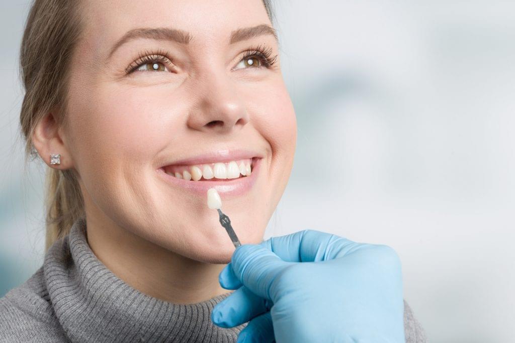 crowns vs veneer